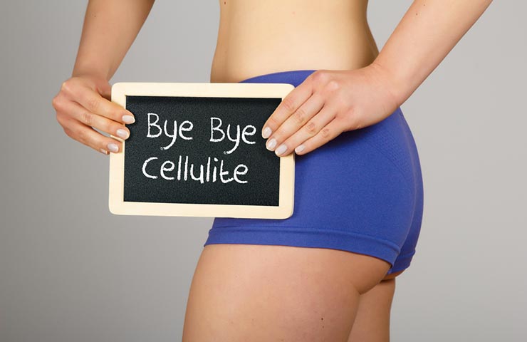 Best Anti-Cellulite Products and Ingredients of 2019